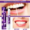 Hbesty V34 Teeth Whitening Pen Gentle Oral Care Gel For Removing Stains 5ml