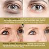 EELHOE Eye Patch Cares the lines around the eyes, moisturizes the skin around the eyes, dark circles, eye bags, elastic and moisturizing eye mask 