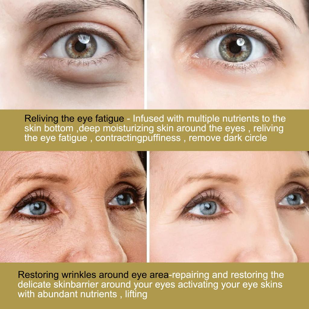 EELHOE Eye Patch Cares the lines around the eyes, moisturizes the skin around the eyes, dark circles, eye bags, elastic and moisturizing eye mask