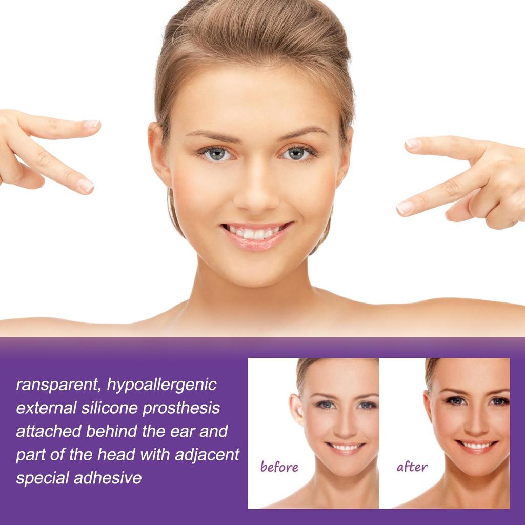 EELHOE Ear Corrector Patches 6pcs, Ear Size Reduction Corrector for Prominent Ears, Waterproof Ear Shaping Patches