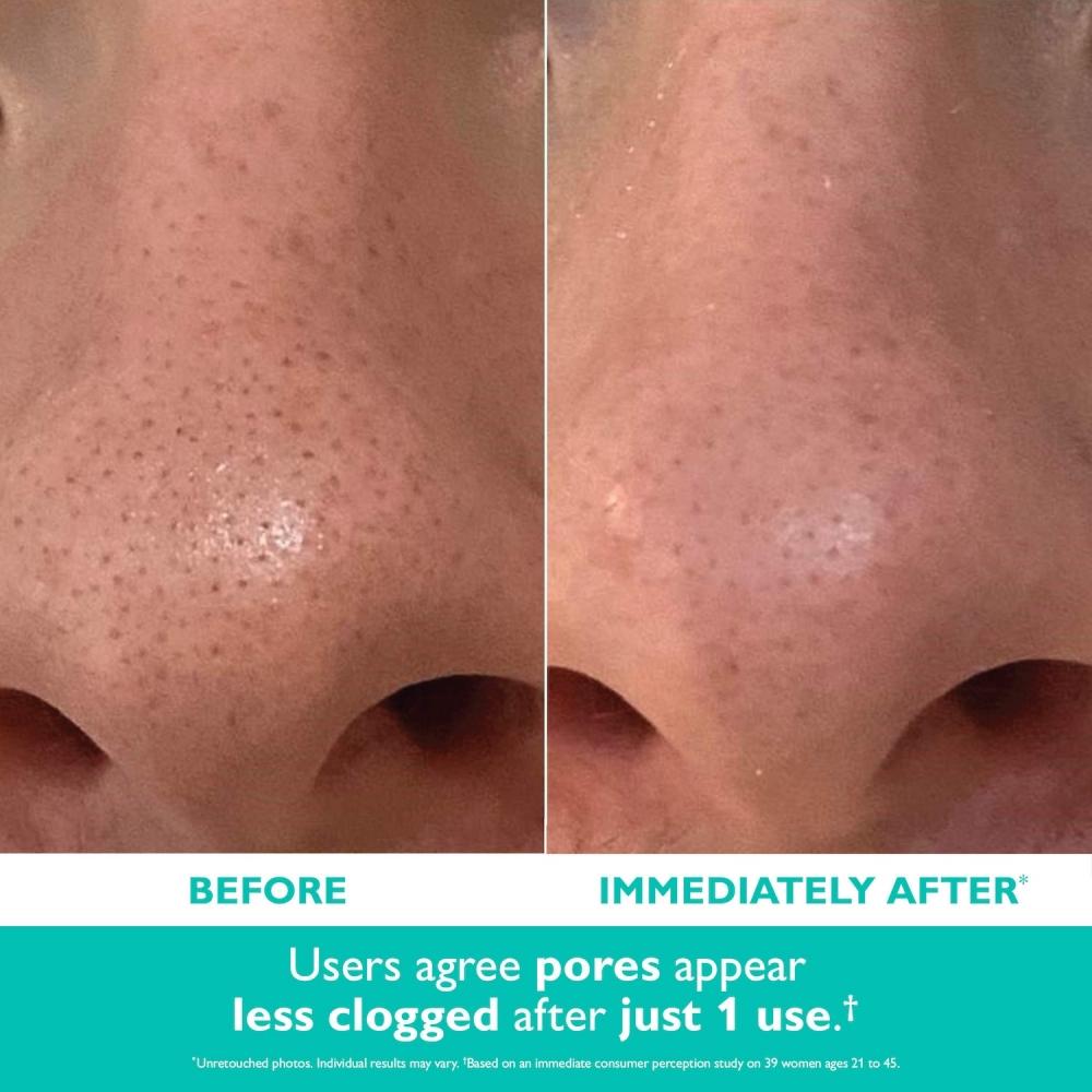 Peter Thomas Roth Even Smoother Microdermabrasion Exfoliating Pore Purifier 1.7 Oz