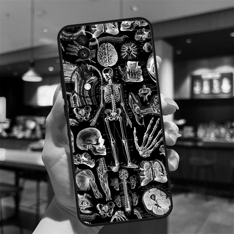 

Medical Skeleton Anatomy Case For Honor Magic 8 6 7 Pro Honor 400 200 70 90 Lite X8b X8c X9a X9b X9c X9d Win RT Cover Honor X8c