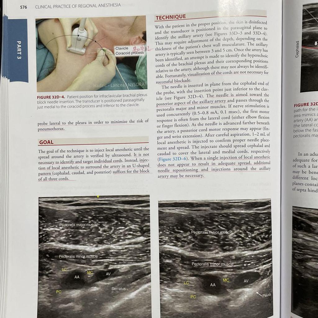[USED] Hadzic's Textbook of Regional Anesthesia