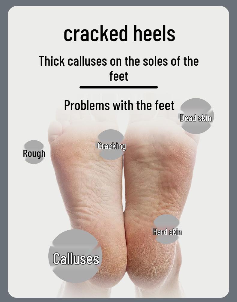 Rechargeable Electric Pedicure Callus Remover & Grinder Tool