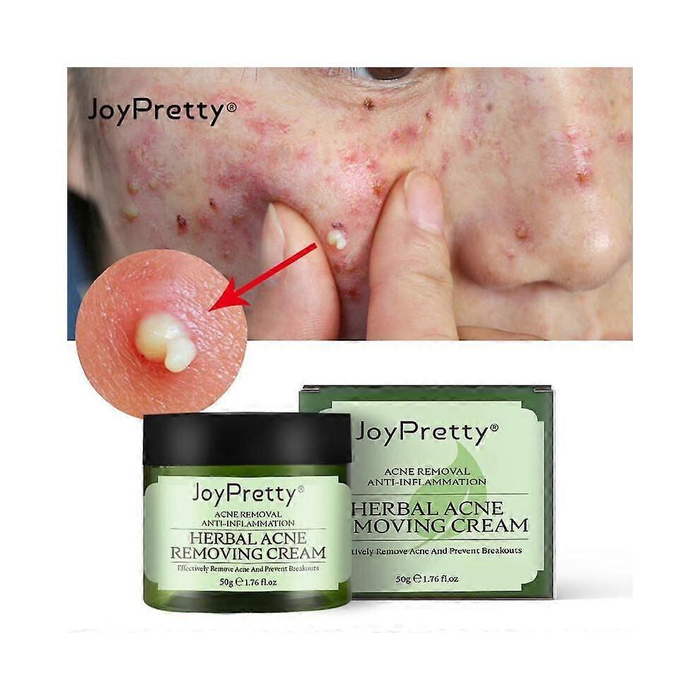 3Pcs JoyPretty Herbal Acne Removal Face Cream Against Pimple Remover Ance Treatment Anti Ance Moisturizing Repair Damage Skin Care