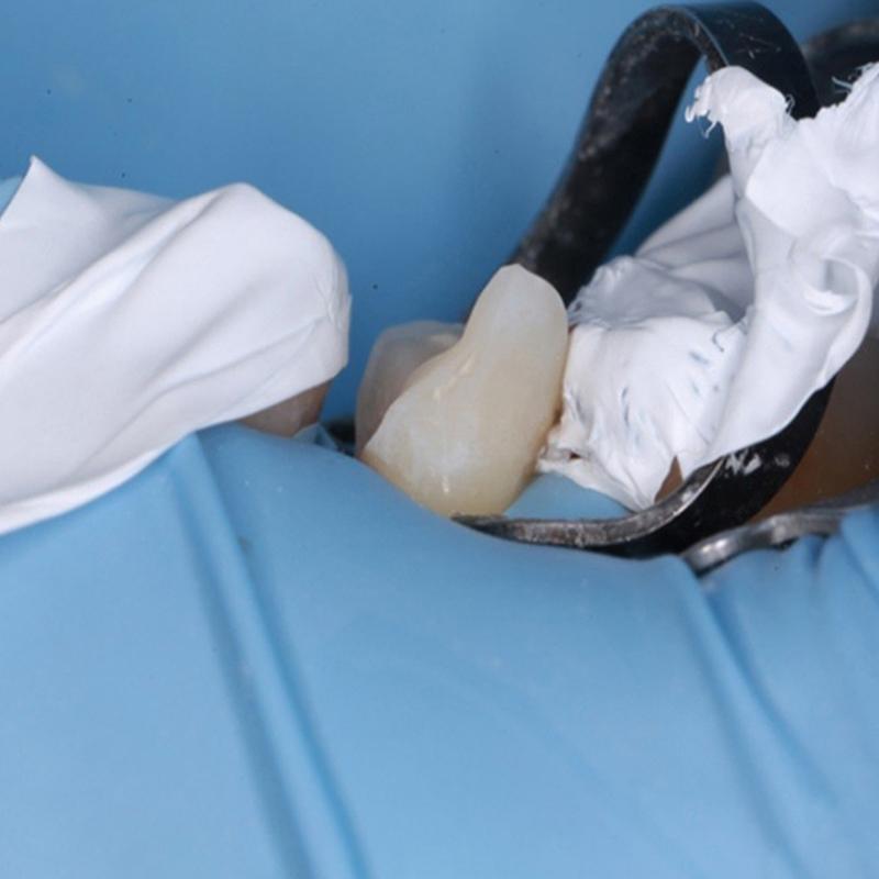 5M Dental Teflon Matrix Bands White Ptfe Raw Material Belt Contoured Matrices Thickness 0.1Mm Dentistry Materials