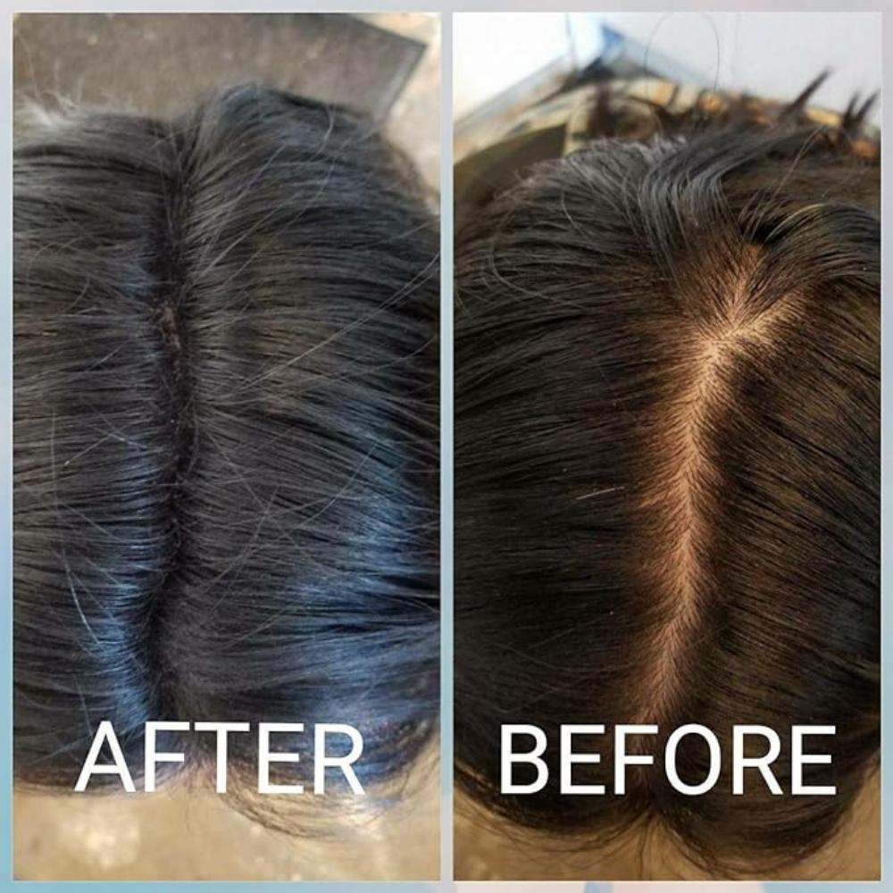 Classic Necessity Easy To Use Lose Hair Building Fibres, 22 G