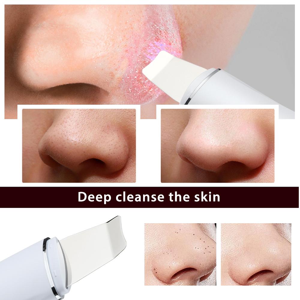 Ultrasonic Skin Scrubber Peeling Shovel EMS Ion Deep Face Cleaning Blackhead Remover Facial Lifting Peeling Shovel Face Massager