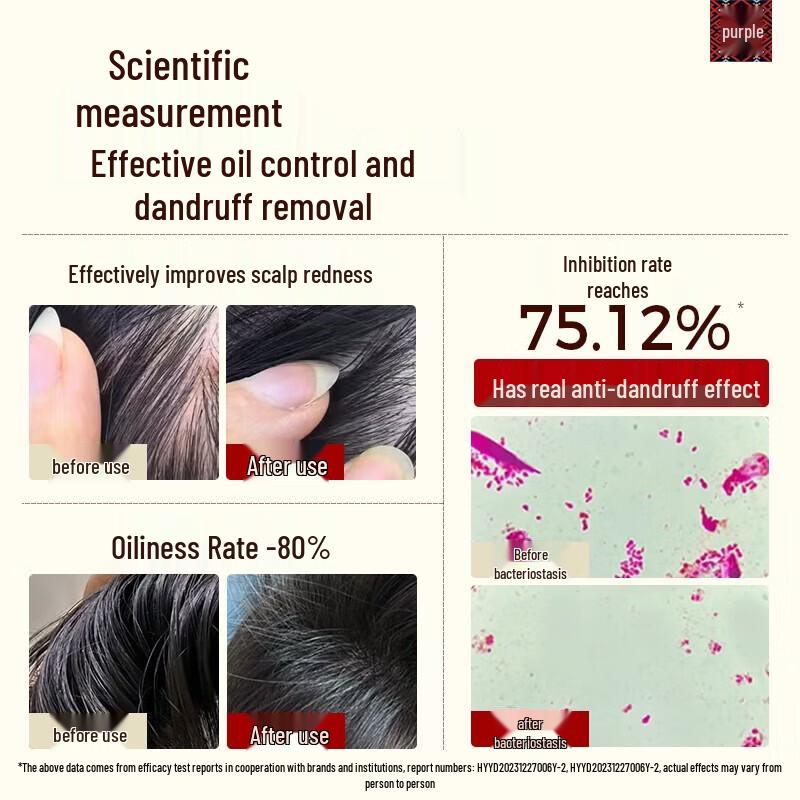 Changfa Xiaozhai Probiotic Anti-Dandruff Nourishing Shampoo