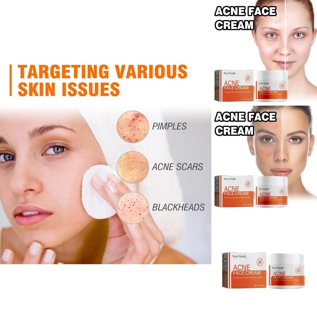 West Month Salicylic Acid Facial Mask Gentle Cleansing Reduces Acne Scars Pore Tightening