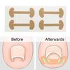 Yousheng 10Pcs Ingrown Toenail Correction Patches Nail Straightener for Pain Relief & Nail Recovery Ingrown Toenail Corrector Kit for Toenail Fungus