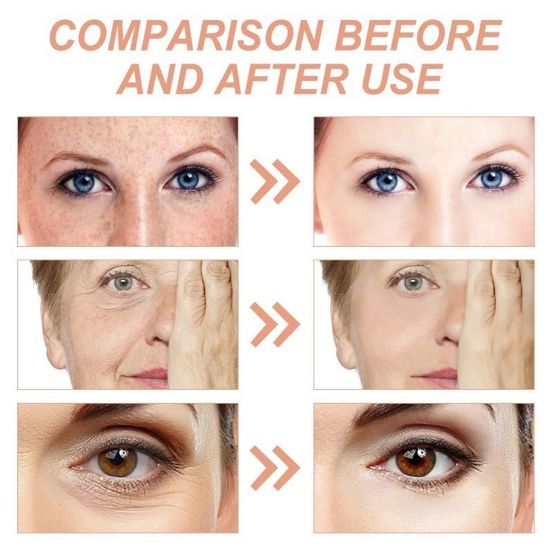 Hoygi Firming Face Cream For Reducing Fine Lines And Dark Spots With Whitening Hydration