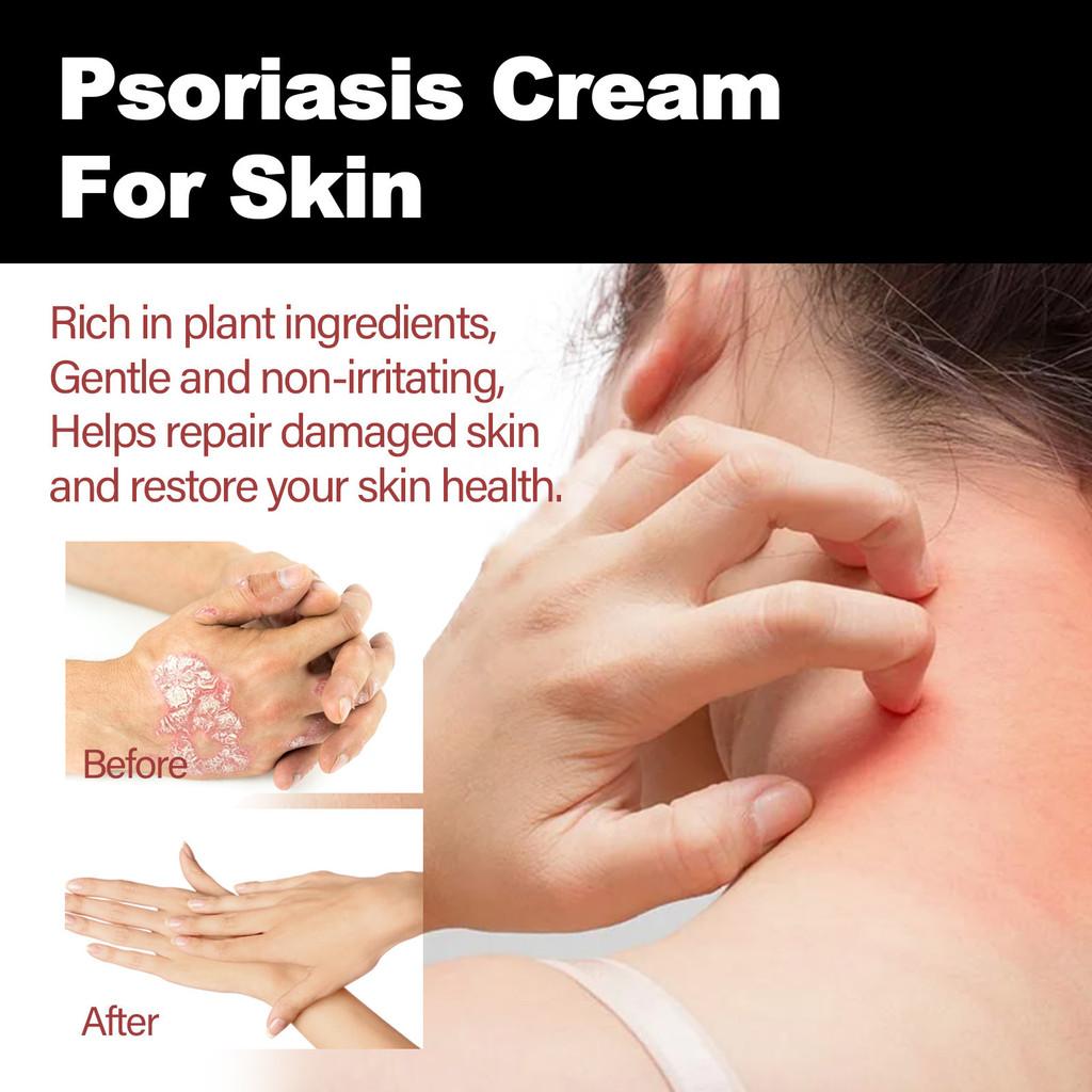 Ximonth Skin Repair Spray Soothing Hydrating Relief For Itchy Red Skin Moisturizer