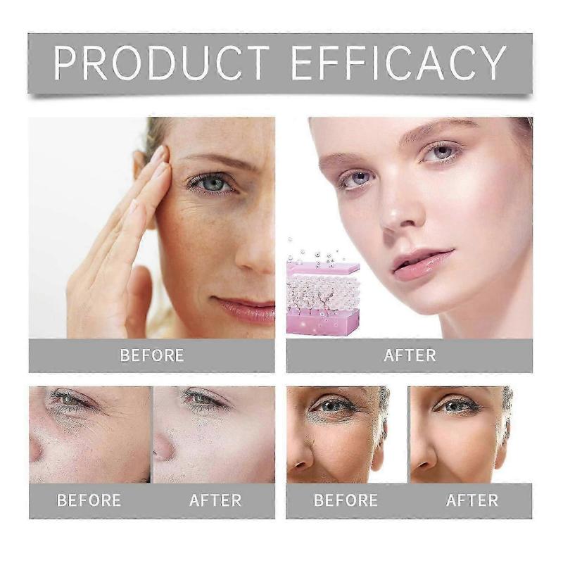 Micro Infusion System for Face, Micro Needling Infusion Kit, Skincare Christmas Gift Set for Women, Anti-Aging & Smooth Wrinkles Facial Serum (2+6)