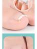 Nickel-Titanium Ingrown Toenail Corrector: Invisible, Wearable Nail Hook for Pain Relief