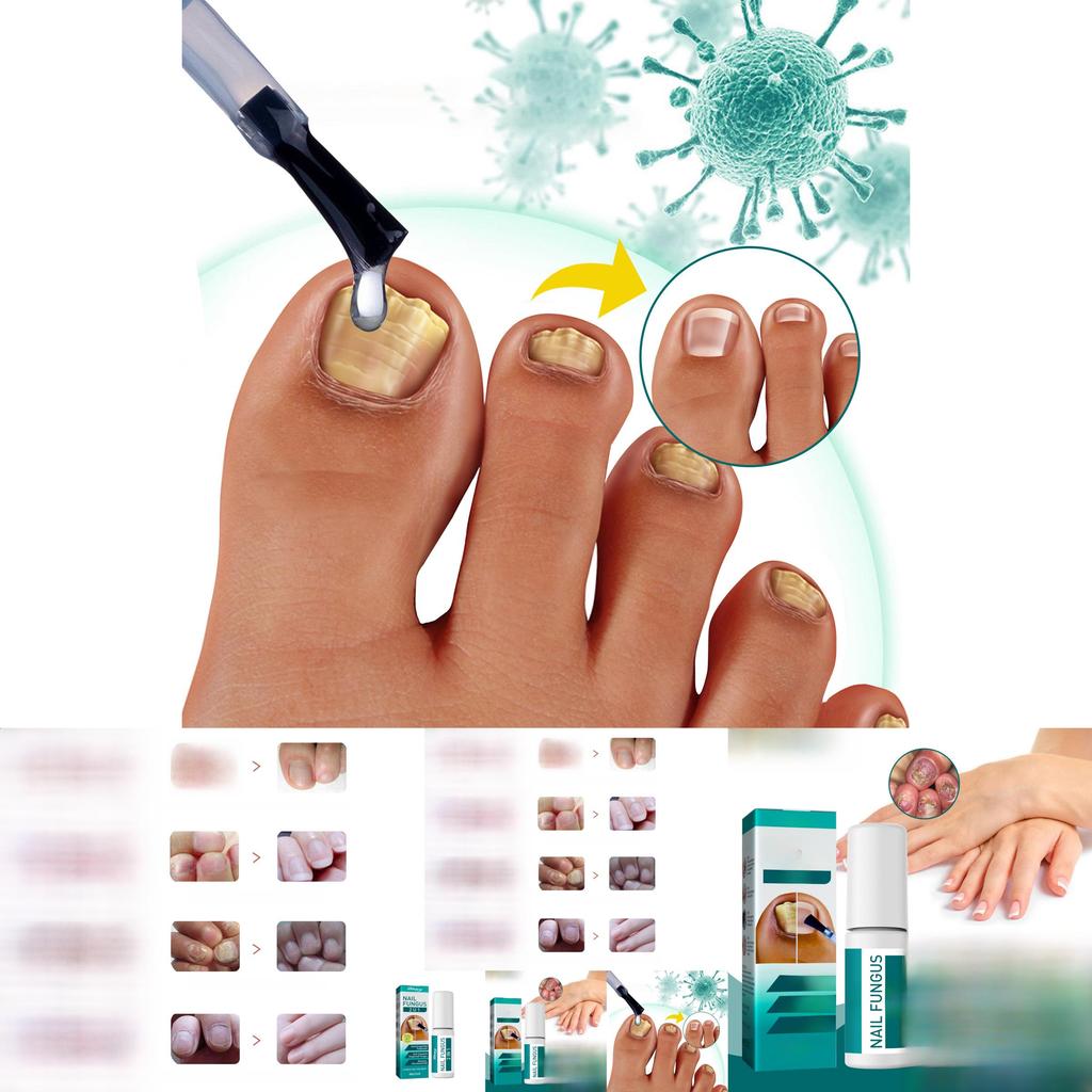 Преміальний розчин для відновлення нігтів на ногах 5 мл Для знебарвлених нігтів і пом'якшення нігтів