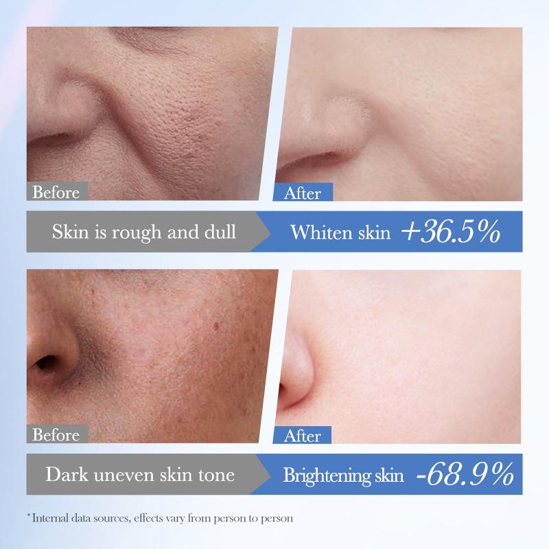 White Rice Niacinamide Cream 50g Care Delicate Brightening Cream Skin Care Products