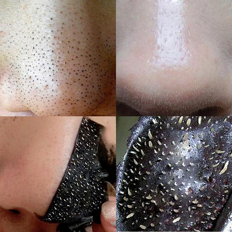 10Pcs Nose Blackhead Remover Mask Deep Cleaning Shrink Pore Acne Treatment Mask