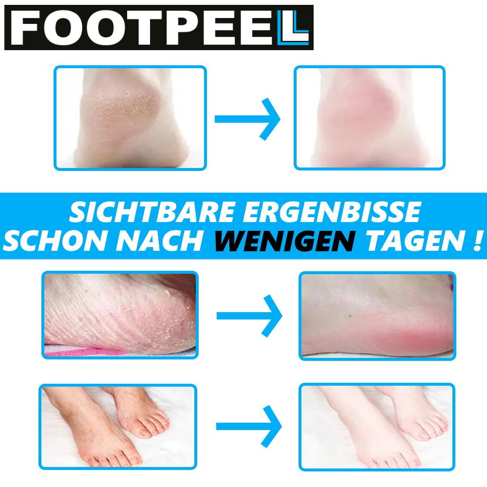 FOOTPEEL Fuß-Peeling Maske Foot Mask Weiche Hornhaut Entferner Socken Aloe [2x]