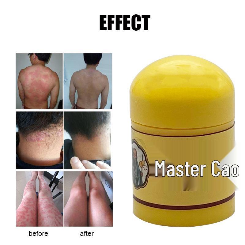 Mr. Cao's Antibacterial Skin Itch Relief Cream