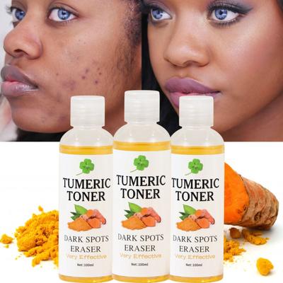 Lozione Ammorbidente per la Pelle Tonico alla Curcuma Scurante 100ml