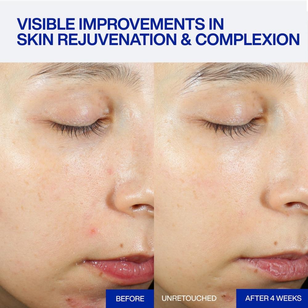 Iope Caffeine Shot Serum For Puffiness 1.01 Oz 30ml Expert Pdrn