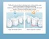 Portable Ultrasonic Oral Irrigator with Rotating Nozzle for Tartar Removal