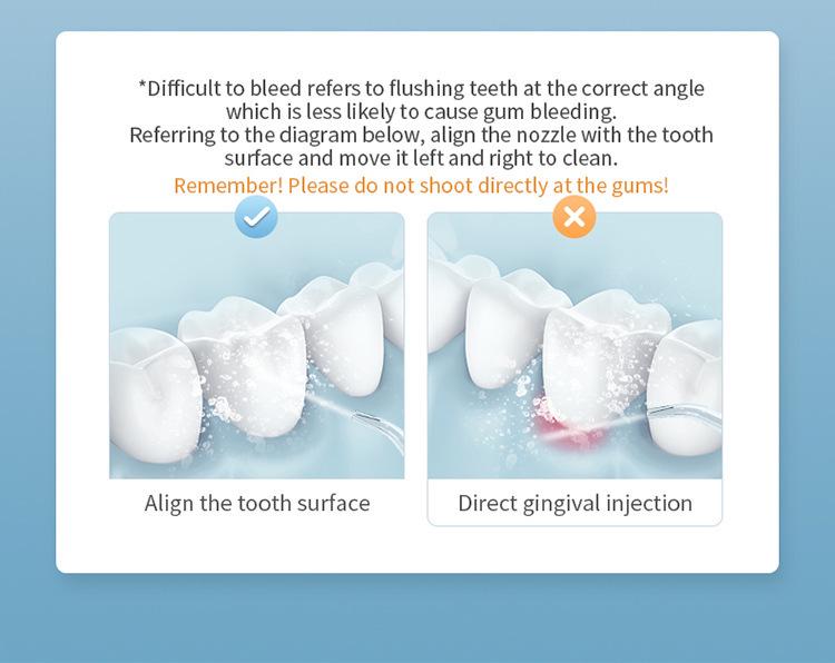Portable Ultrasonic Oral Irrigator with Rotating Nozzle for Tartar Removal