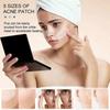 240Pcs Large Acne Patch Pimple Hydrocolloid Stickers Spot Cover Remover Treatment