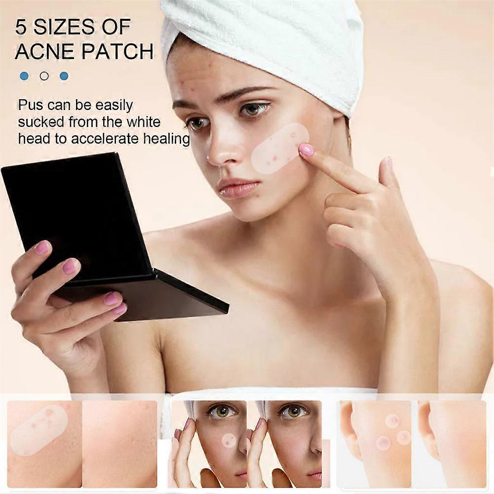 240Pcs Large Acne Patch Pimple Hydrocolloid Stickers Spot Cover Remover Treatment