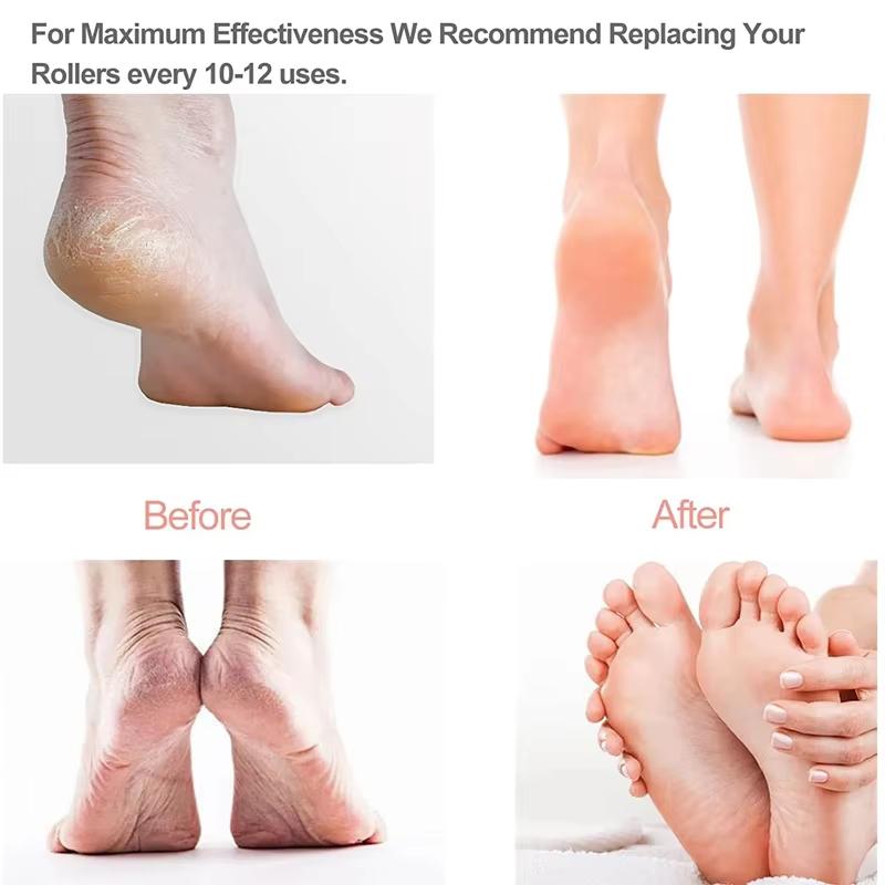 Rechargeable Electric Callus Remover Cordless Women Men Electronic Foot File Removes Dry Coarse Skin Calluses On Heels