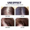 2pcs Moisturizes Scalp Extract Ginger Regrowth Germinal Oil Hair Care Ginger Hair Growth Serum Spray