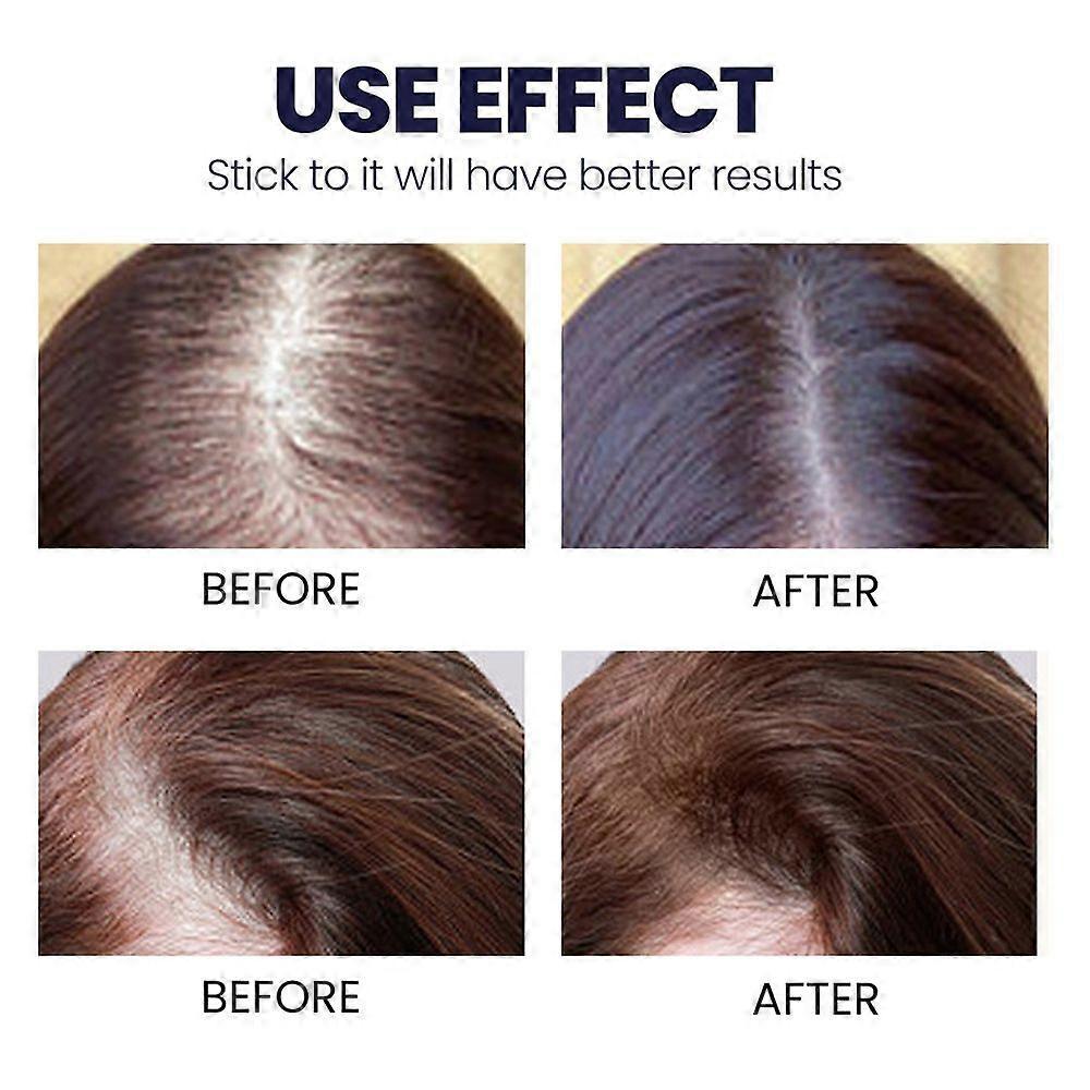 2pcs Moisturizes Scalp Extract Ginger Regrowth Germinal Oil Hair Care Ginger Hair Growth Serum Spray