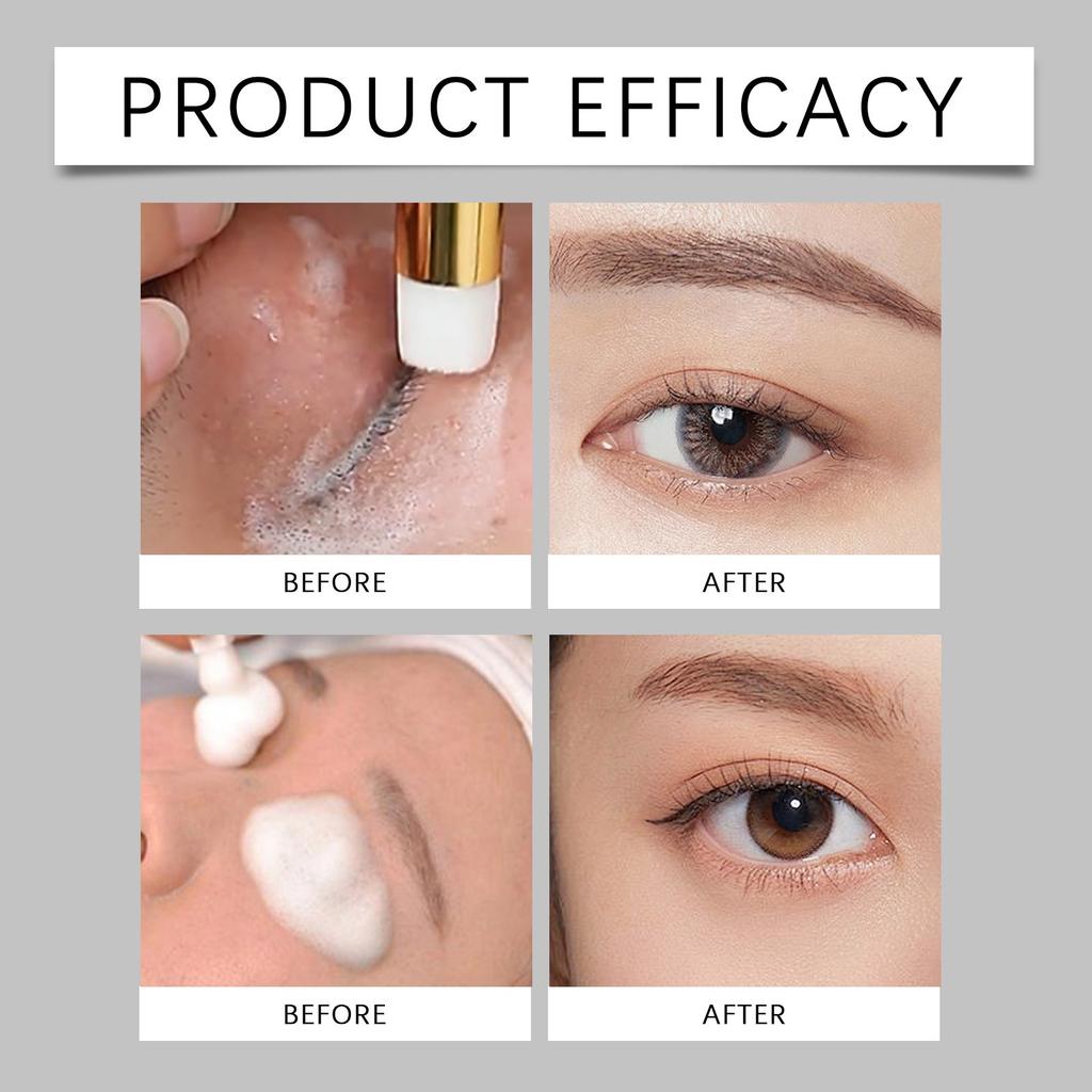 No-rinse Eyelid And Eyelash Cleansing Reduces Red Eyes, Moisturizes Dryness And Relieves Itching. No-rinse 50ML