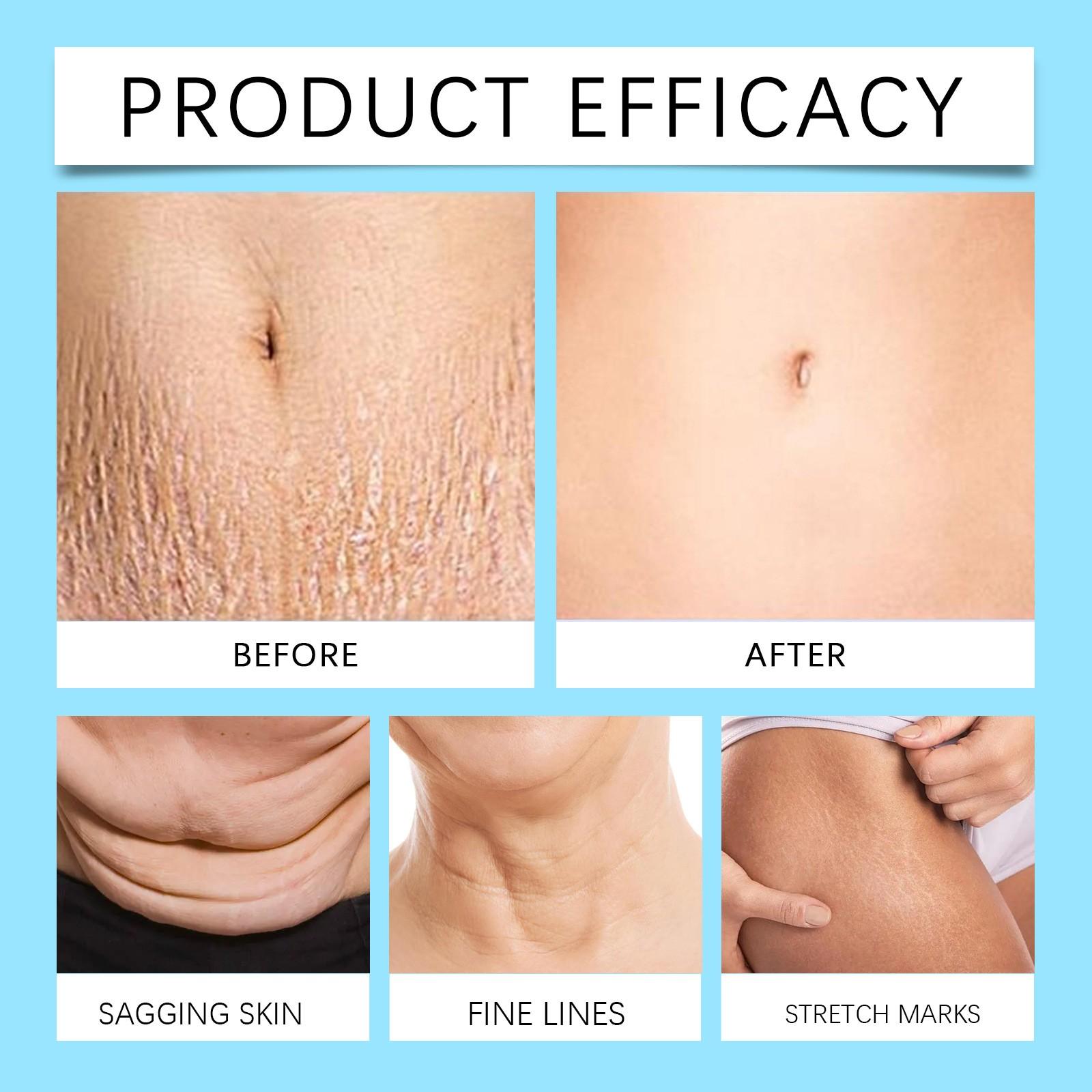 Увлажняющий — фото 3