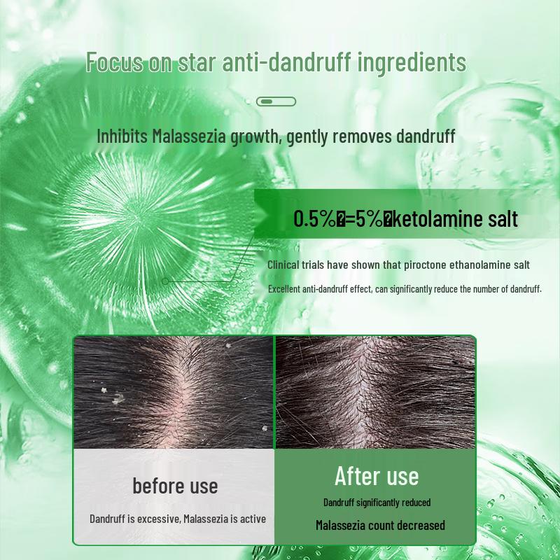 ZhuoLanYa Anti-Dandruff Moisturizing Shampoo 680ml