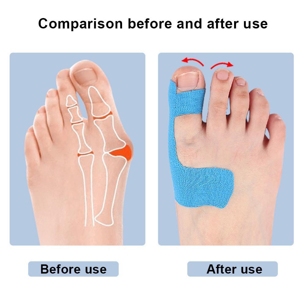 10Pcs Kinesiology Tape For Bunion Corrector Big Toe Support Pain Relief Hypoallergenic Latex-Free