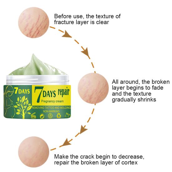 Pregnancy Repair Cream Stretch Removal Easy to Absorb Natural Extracts Skin Scar Remove Cream for Mother