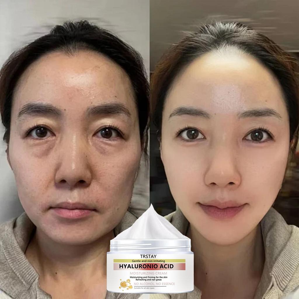 Brighten and Anti-aging Essence Cream, Even Skin Tone, Whiten and Repair, Nourish Skin, Moisturize and Moisturize Skin Cream