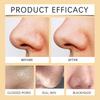 Gel Exfoliante Iluminante con Enzimas - Gel Limpiador Suave con Niacinamida y Vitamina C, Purificante Profundo de Poros, Eliminación de Puntos Negros (Neto 100ml)