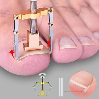 Corrector de uñas encarnadas - 1 pieza, suaviza y recorta fácilmente, parche de recuperación de uñas para pedicura, cuidado de pies sin olor