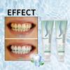 Nano Hydroxyapatite Toothpaste Mint To Remove Bad Breath Whitening Stain Removal Toothpaste Fresh Breath