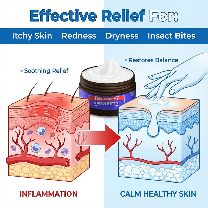 Chinese Herbal Skincare Cream - Specially Formulated for Itchy, Irritated Skin