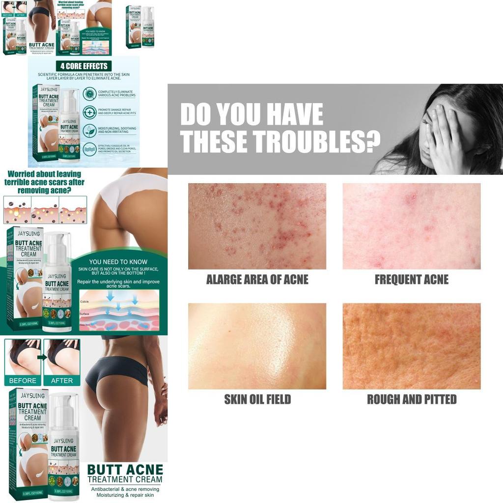 Jaysuing Butt Care Cream Nourishing Moisturizing Formula For Clear And Smooth Skin
