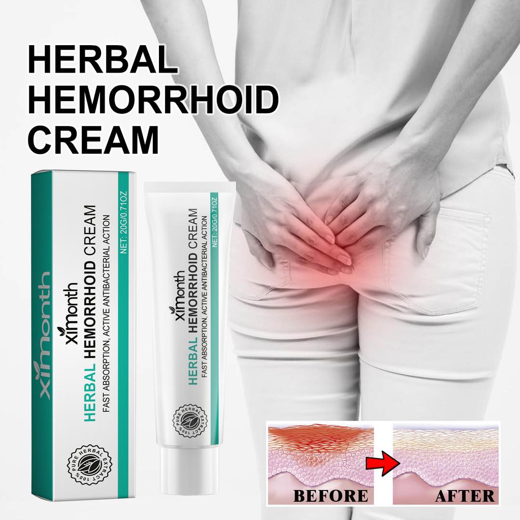Ximonth Hemorrhoid Cream Soothing Relief For Anal Itching Discomfort And Pain