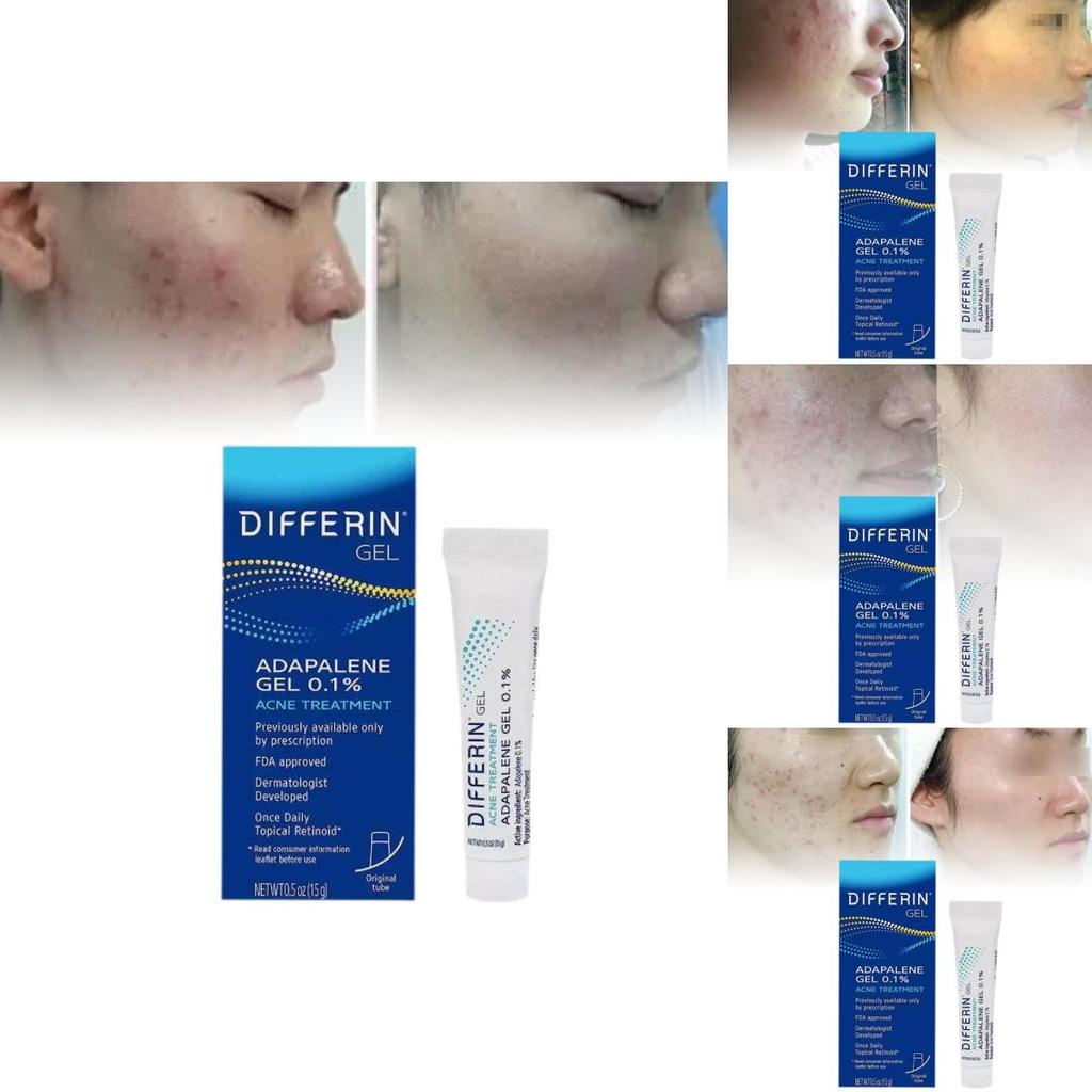 Differin Gel Traitement Acné Gel Rétinoïde Pour Peau Claire Radieuse 15g
