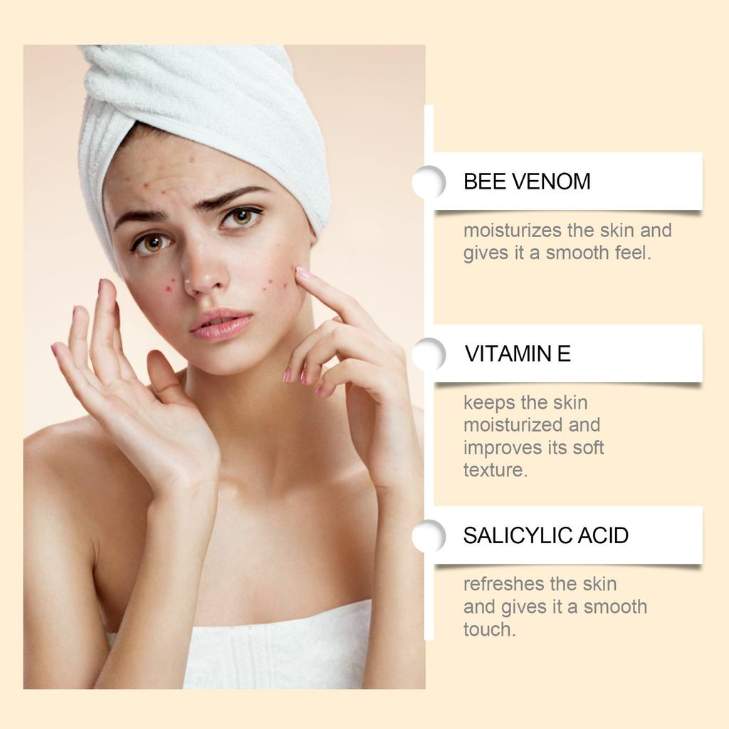 Acne Soothing Cream Gently Cleanses And Smoothes The Skin Hydrates The Skin Anti-aging Firming Gentle Skin Care Moisturizing Hydrating Skin Care