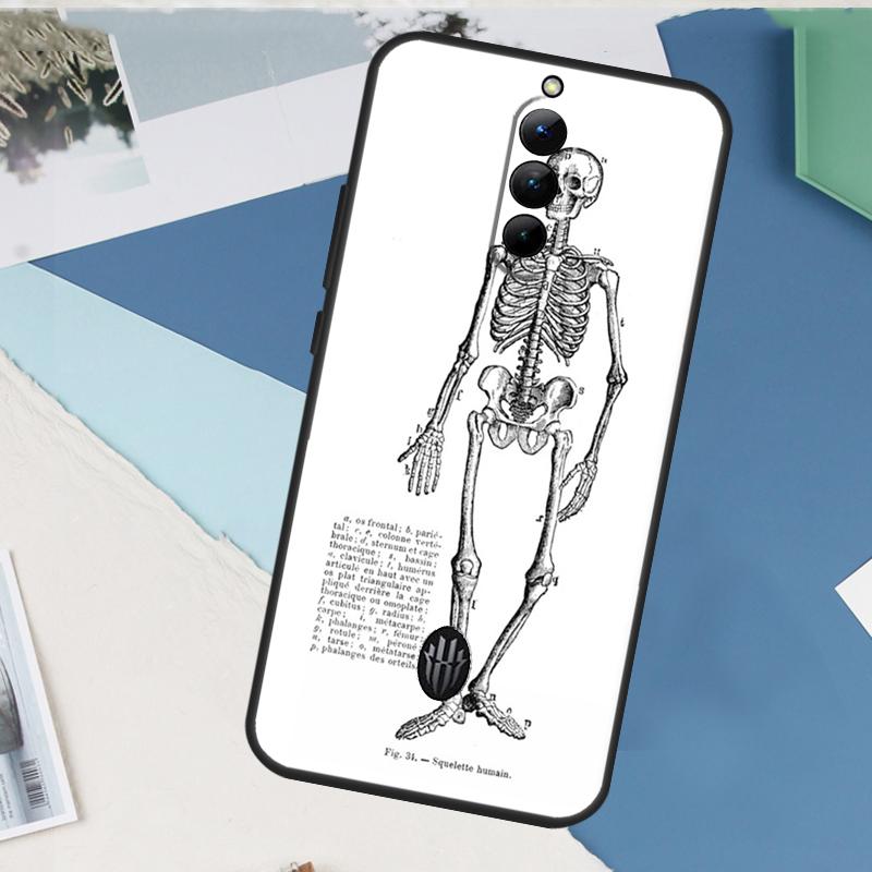 Skelett Kunst Etui Für ZTE Nubia Red Magic 11 10 9 8 8S 9S 10S Pro Plus 6 7 6S 7S Pro 5G 6R 10 Air Hülle