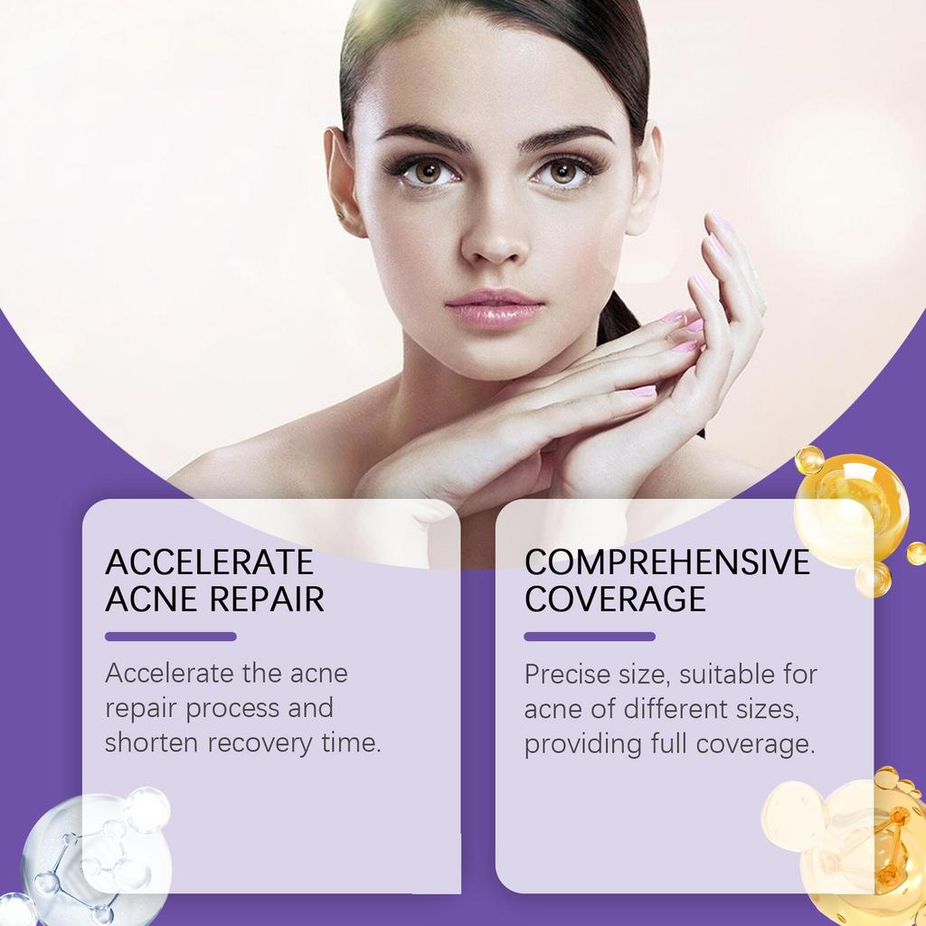 Hoygi Acne Patches Repair facial acne and blackheads Facial skin care acne concealing patches