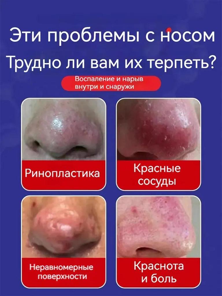 Spezialpflaster für Rosacea rote Nase Erdbeernase